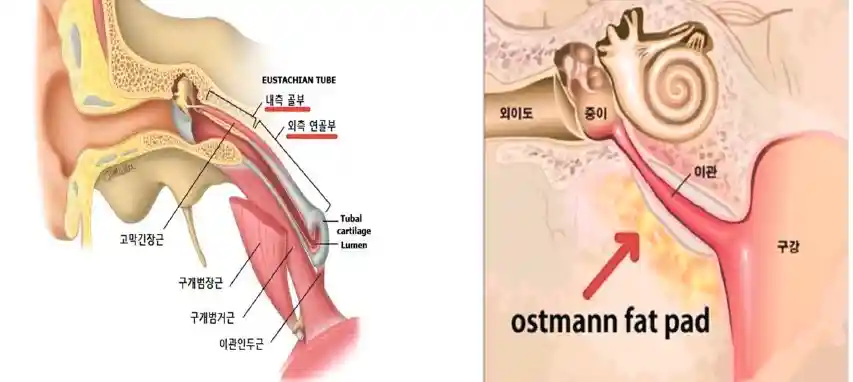 이관개방증