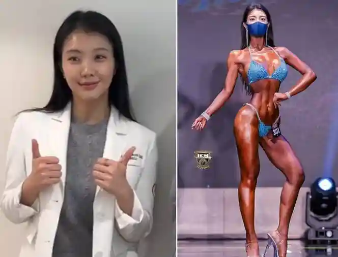 100kg대에서 체중 감량한 의사